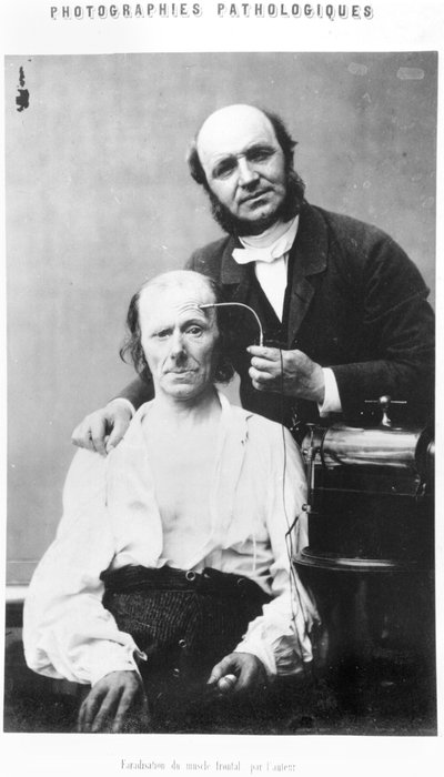 Faradisation of the Frontal Muscle (from 